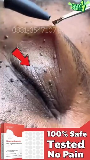 ⏳ Skin Tags ka Asaan Hal! 🌿 Ab paayein smooth aur clear skin Derma Smooth Skin Tag Removal Patches ke sath — bina dard, bina laser! ✨ ✅ Skin ke liye safe aur gentle ✅ Jaldi aur visible results ✅ Ghar baithe easy use 🚚 Cash On Delivery poore Pakistan mein 📲 Order karein abhi WhatsApp par: 0331-3547107 ya Tap karein Shop Now! | Smart Accessories