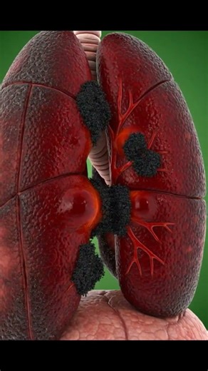 Cigarette Smoking Impact on Lungs | 3D Human Anatomy Animation #ai #science #healtheducation