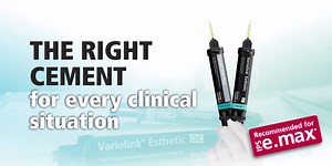 2.7K views · 66 reactions | Cementation solutions: SpeedCEM Plus &...