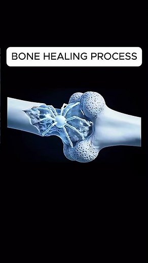 BONE HEALING PROCESS