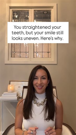 Dr Brittany Dickinson | Porcelain Veneers on Instagram: "Why does my smile still look uneven after Invisalign? There are a couple factors that are very easy to tweak at the end of straightening your teeth. Whether we do an ectomy, or an enamel of plasty, the small changes are the finishing touches for your smile! #InvisalignBeforeAndAfter #SmileTransformationChicago #StraightTeethChicago #CosmeticDentistryChicago #ChicagoSmileMakeover"