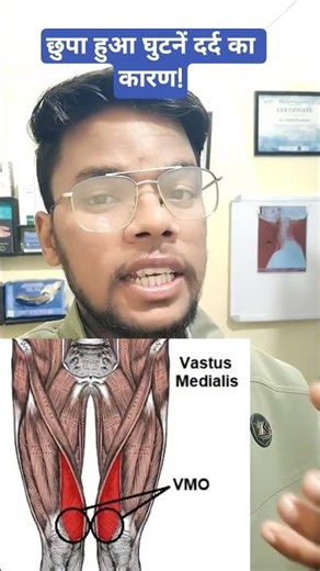 घुटने दर्द का छुपा कारण | Patellar Tracking Problem