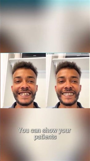 Discover new features in Invisalign® Outcome Simulator Pro