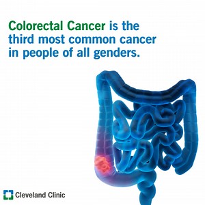 816 reactions · 157 shares | Access our FREE guide to discover how colorectal cancer is diagnosed and explore the innovative treatment options available. | Cleveland Clinic | Facebook
