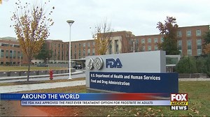 FDA Approves First-Ever Frostbite Treatment Option For Adults - WFXB