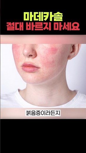 How to Properly Use Madecassol, Explained by a Dermatologist