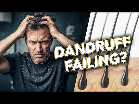 Dandruff Solved: Why Your Medicated Shampoo is FAILING You (A New Approach)