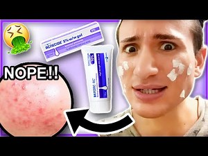 I tried BENZOYL PEROXIDE Acnecide for ONE WEEK!! (it caused a rash?!)