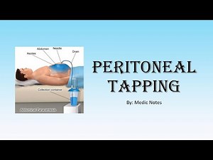[Houseman preparation procedures] Peritoneal tapping/ Paracentesis - procedural steps