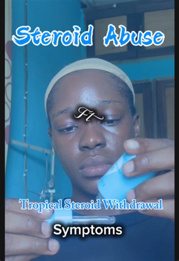 Understanding Tropical Steroid Withdrawal Symptoms
