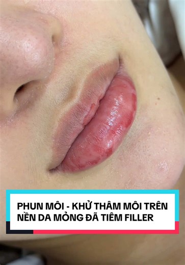 Phun Môi cho eiuu - nền da cực kì mỏng va bị rách xước rất nhìu🆘 2 ngày thui bong sẽ lột xác nha🥰 #moi #phunmoi #phunmoidep #phunmoihanoi #phunmoitunhien