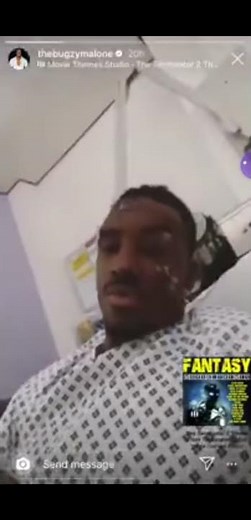 Bugzy Malone BEEFS man in hospital After major bike Crash ! (exclusive) #shorts