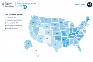 ‘State of Lung Cancer’ report finds dramatic disparities among communities of color - WTOP News