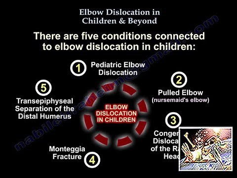 Pediatric Elbow Dislocation In Children - Everything You Need To Know - Dr. Nabil Ebraheim