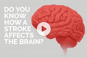 What Happens to the Brain During a Stroke?