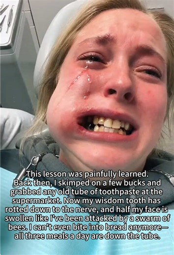 Effective Solutions for Yellow Teeth Whitening