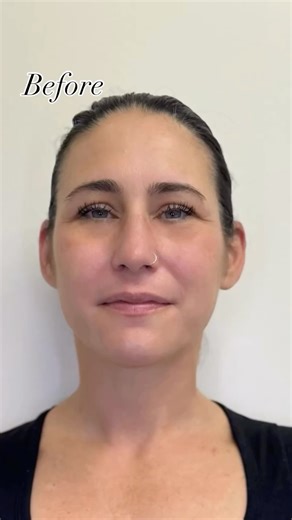 ARABROWS on Instagram: "Working together with this client to create soft powder brows with intention — focusing on shape and symmetry for a naturally balanced result 🫶 A gentle reminder that brows are always darker at first and will gradually lighten as they heal 👍 If you’d like to work together on bringing balance or enhancing your brows, DM or text 631-488-5464 for more info :) #powderbrowslongisland #softpowderbrows #naturalenhancement #intentionalbeauty #pmuartist"