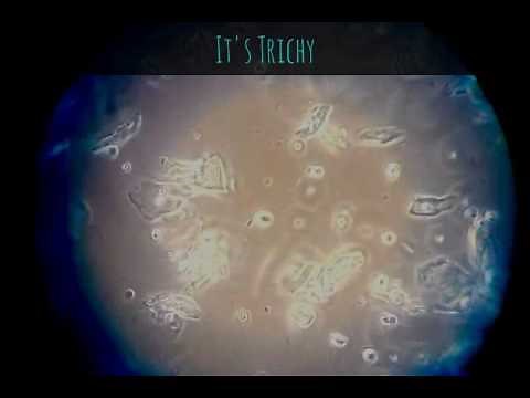 Trichomonas (Trich) Under the Microscope
