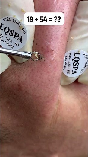 Blackheads 2026 newest dr pimple popping videos Ep10