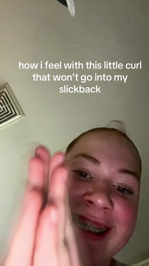 she’s bald