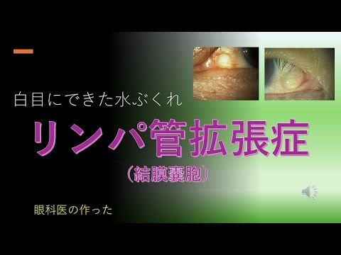 リンパ管拡張症。白目に水泡？