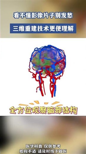 Demystifying 3D Tech: No Fear of Missed Clips