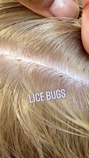 The Louse Girl Lice Removal on TikTok