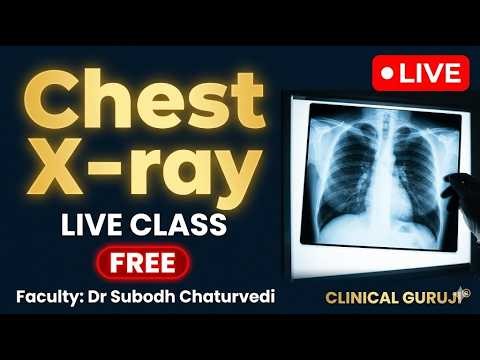🔴X-Ray Chest – LIVE Class with Dr. Subodh Chaturvedi | 28th March, 9:00 PM