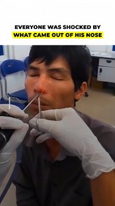 36K views · 138 reactions | Everyone was shocked by what came out of his nose, especially since the animal was ALIVE . | Vitamin | Facebook