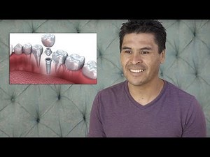 Dental Implant procedure with IV Sedation with Dr. Hanookai in Los Angeles CA Spanish speaking
