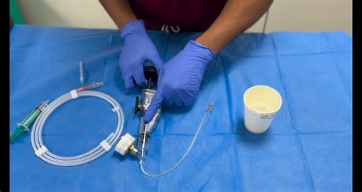 RAMAKRISHNA on Instagram: "👉demonstration of Indifilator in Cathlab ❤️… @cathlab_knowledgeable #followｍe #cathlab #CathLabTechnologist #medicalreels #reelsindia"