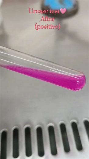 Microbiogram on Instagram: "some biochemical test for bacteria before and after 😍 #microbiology #microbiologist #lab #laboratory #mikrobiyoloji #microbiologia #cell #culture #fyp #viral #explore #kesfet #bacteria #virus #fungi #parasite #virüs #mantar #parazit #life #knowledge #know #fact #reel #microbe #science #molecular #bacteriology #virology #PhD"
