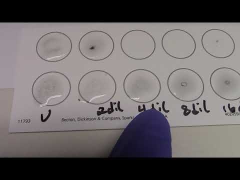 RPR Test (with RPR titer) Part 2