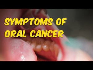 Symptoms of Oral Cancer #EarlySigns