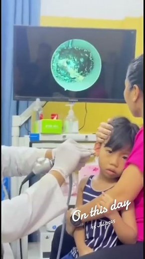 🔥 Extreme Earwax Removal with Stunning Results! #earwaxremoval #doctor #shorts