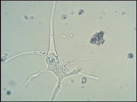 The Microscopic Life in a Pond - 1000x magnification