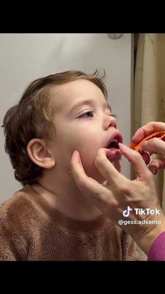 Como usar fio dental em crianças: Dicas do dentista
