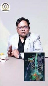 Spinal cord | Back & Neck Pain Treatment Experts | Dr. Anshul Agarwal