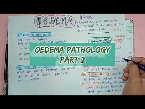 Oedema - Types, Causes, Symptoms & Treatment - Part 2 || Pathology