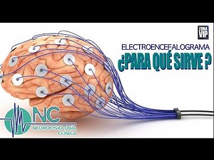 "ELECTROENCEFALOGRAMA"