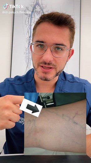 Exploring Human Anatomy: A Focus on Veins