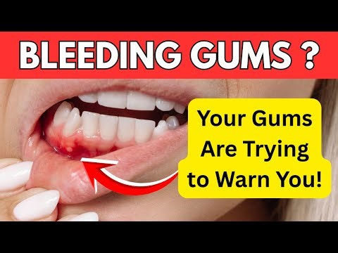 Why Your Gums Bleed When Brushing And How to Fix It ?