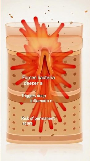 Why You Should NEVER Pop Pimples 😱 | Deep Skin Damage Explained | Body Science