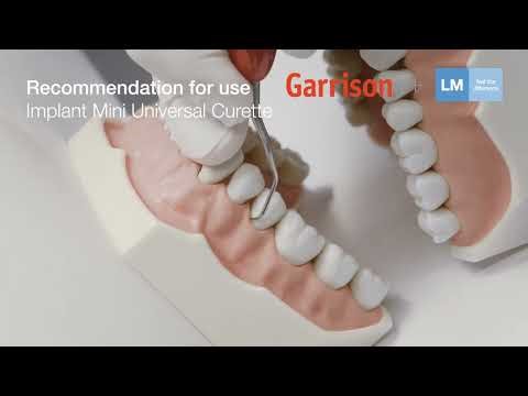 How to use LM-ErgoMix™ hand instruments with titanium implant tips