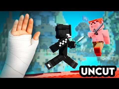 Fighting 100 FKDR Cheater BUT my Wrist is BROKEN | Hypixel Gameplay