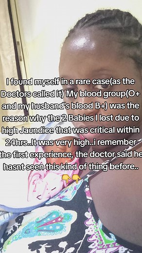 Understanding ABO Incompatibility and Newborn Jaundice