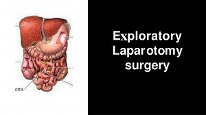 PPT - Exploratory Laparotomy surgery PowerPoint Presentation, free download - ID:12214376