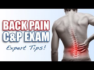 How to CONQUER Your C&P Exam for Back Pain: 4 EXPERT Tips!