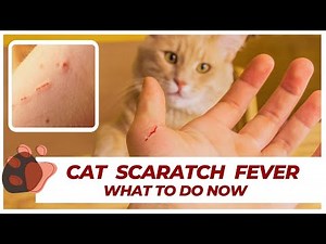 Cat Scratch Disease Symptoms (Cat-Scratch Fever)