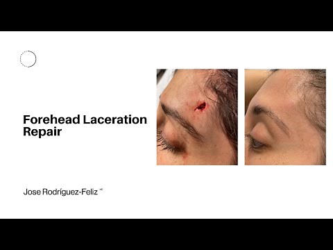 Forehead Laceration Repair